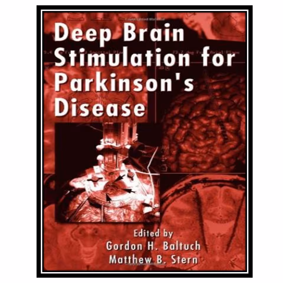 کتاب Deep Brain Stimulation for Parkinson's Disease اثر H. Baltuch Gordon and Matthew B. Stern انتشارات مؤلفین طلایی