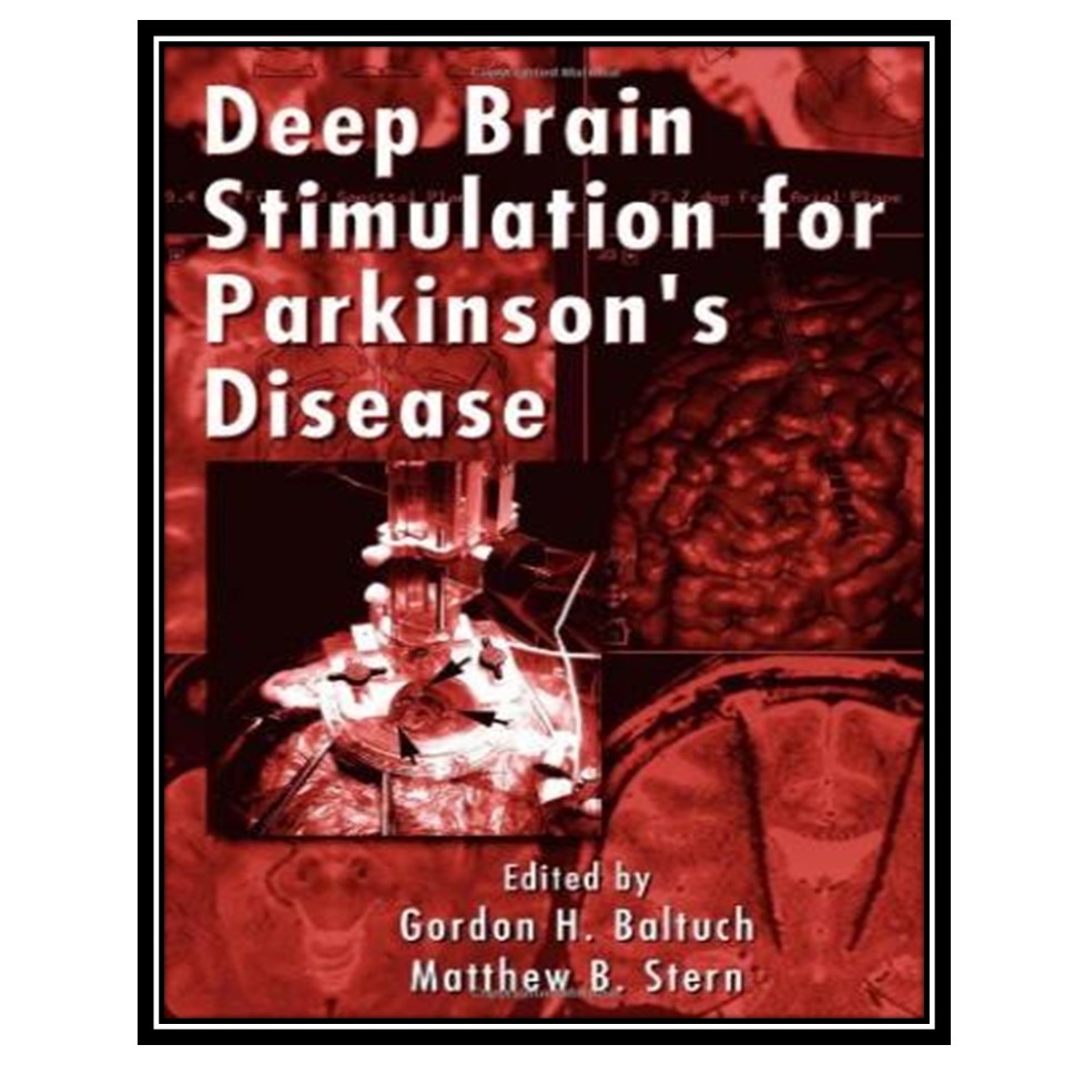 کتاب Deep Brain Stimulation for Parkinson's Disease اثر H Baltuch Gordon and Matthew B Stern انتشارات مؤلفین طلایی