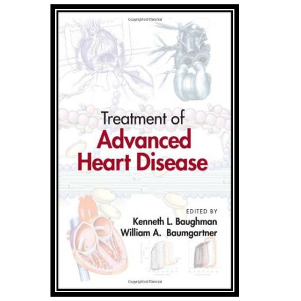 کتاب Treatment of Advanced Heart Disease اثر Kenneth L Baughman and William A Baumgartner انتشارات مؤلفین طلایی