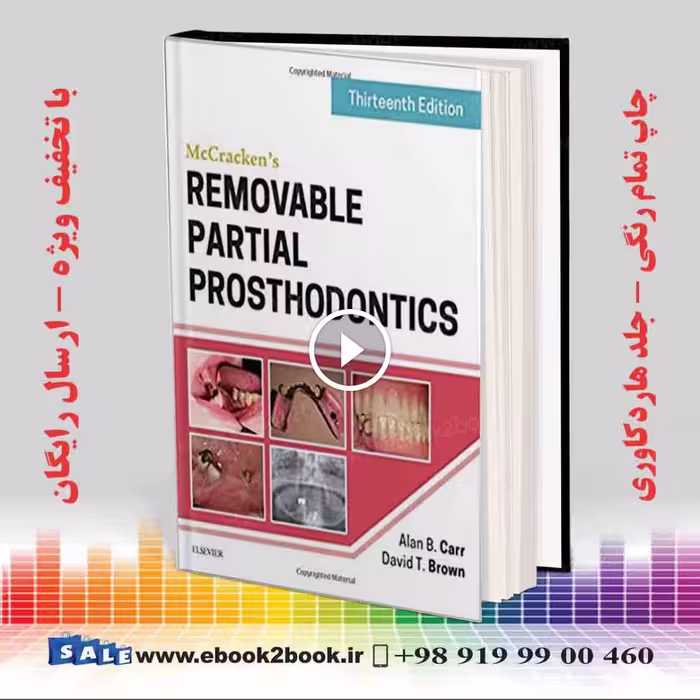 McCrackens Removable Partial Prosthodontics 13th Edition