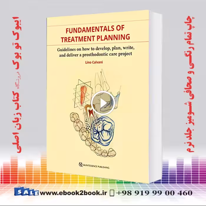 Fundamentals of Treatment Planning