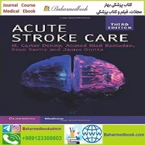 Acute Stroke Care 2020 TRUE PDF price 1€ - کتاب پزشکی بهار