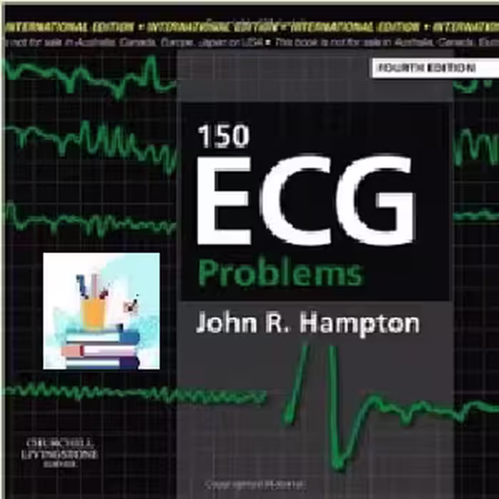 150ECG Problems TRUE PDF price 1€