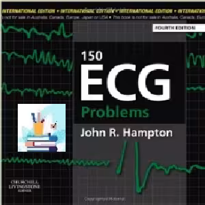 150ECG Problems TRUE PDF price 1€