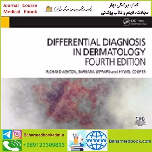 Differential Diagnosis in Dermatology TRUE PDF price 1€ - کتاب پزشکی بهار