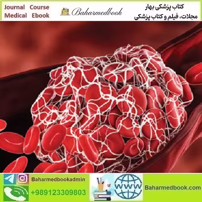 Thrombosis &amp; Thromboembolism 2022 video course price 25€ - کتاب پزشکی بهار