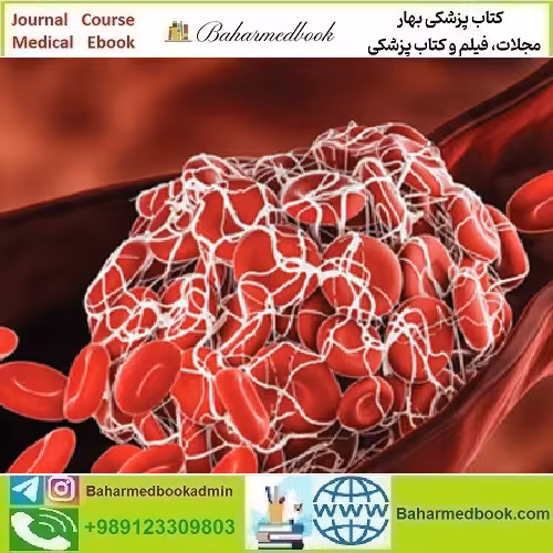 Thrombosis &amp; Thromboembolism 2022 video course price 25€ - کتاب پزشکی بهار