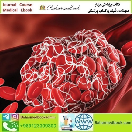 Thrombosis & Thromboembolism 2022 video course price 25€ - کتاب پزشکی بهار