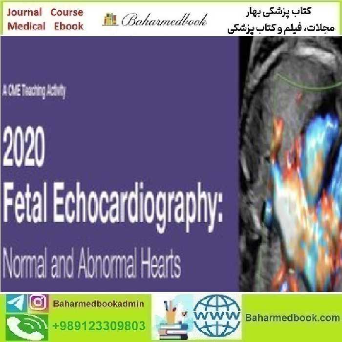 Fetal Echocardiography Normal and Abnormal Hearts 2020 video