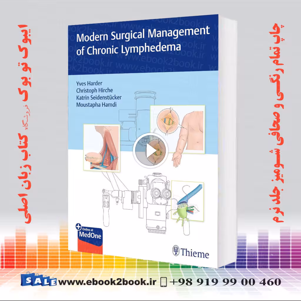 Modern Surgical Management of Chronic Lymphedema