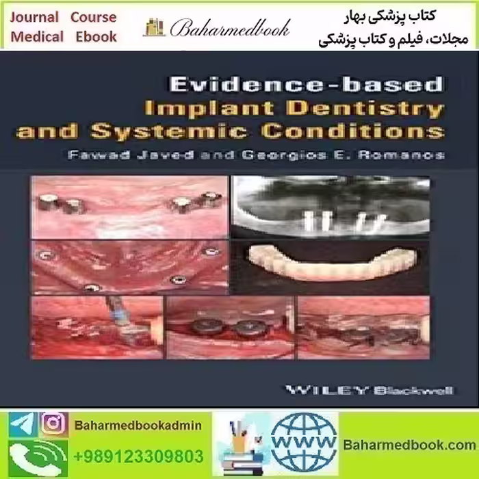 Evidence based Implant Dentistry and Systemic Conditions
