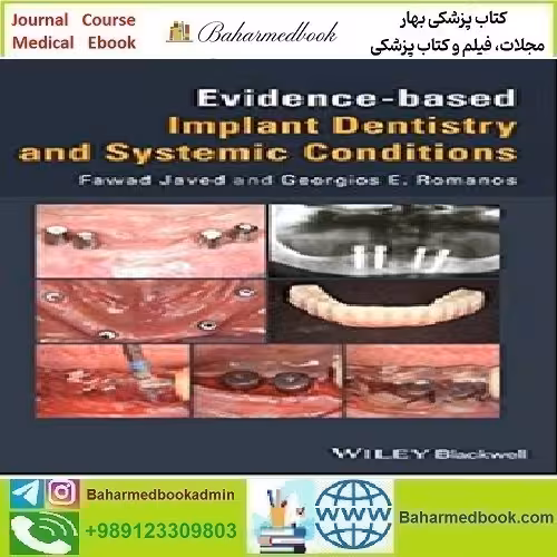 Evidence based Implant Dentistry and Systemic Conditions
