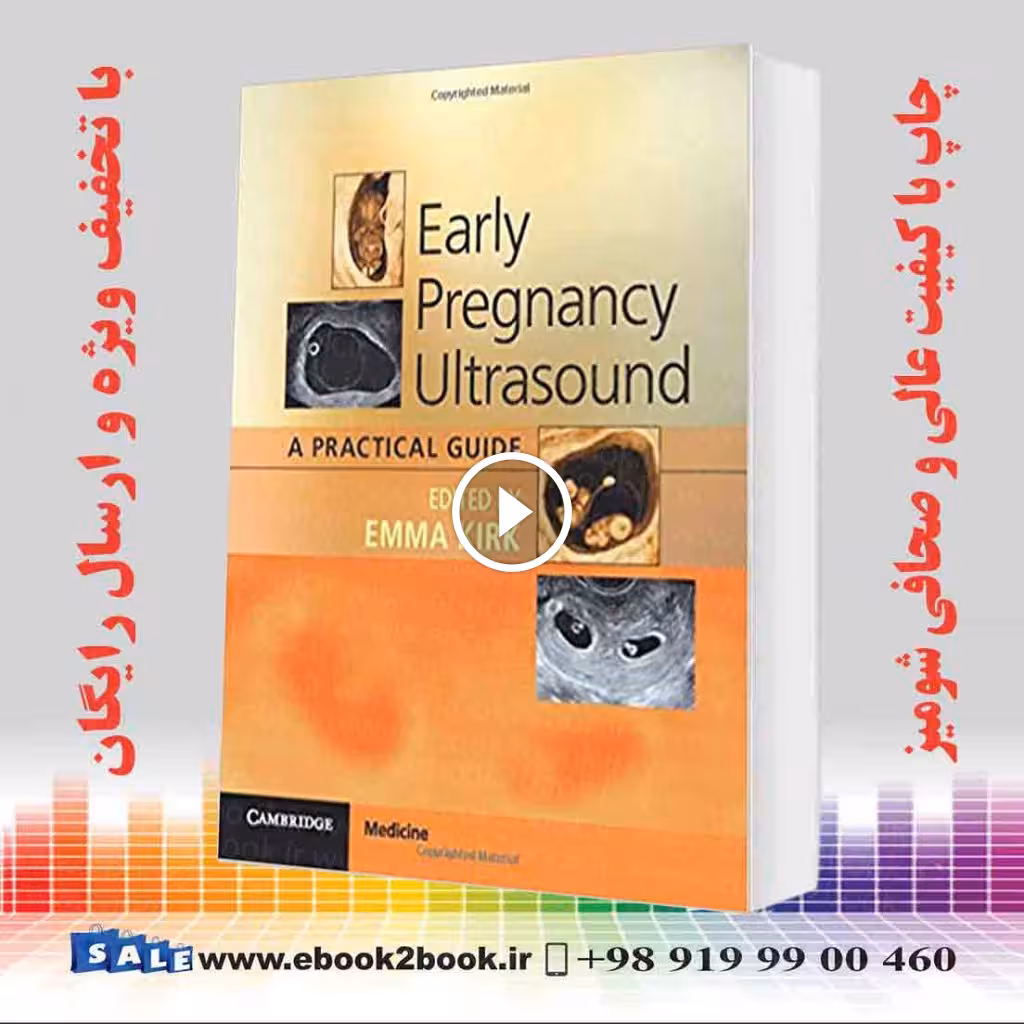 Early Pregnancy Ultrasound: A Practical Guide