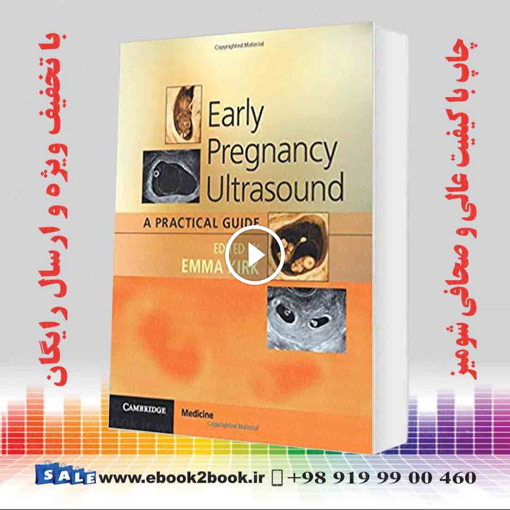 Early Pregnancy Ultrasound: A Practical Guide