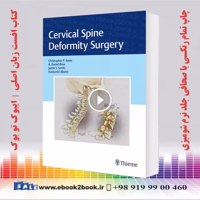 Cervical Spine Deformity Surgery