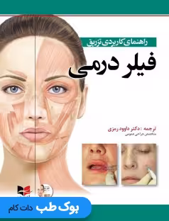 راهنمای کاربردی تزریق فیلر درمی