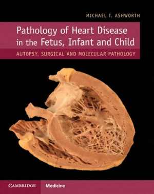 [PDF] دانلود کتاب Pathology Of Heart Disease In The Fetus, Infant And Child - Autopsy, Surgical And Molecular Pathology, 2019