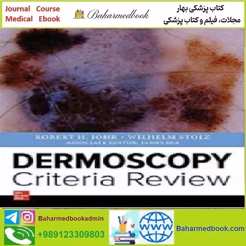 Dermoscopy Criteria Review TRUE PDF price 1€ - کتاب پزشکی بهار