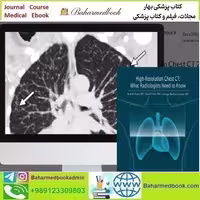 ARRS High Resolution Chest CT 2024 video course price 55€ - کتاب پزشکی بهار