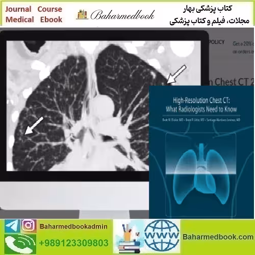 ARRS High Resolution Chest CT 2024 video course price 55€ - کتاب پزشکی بهار