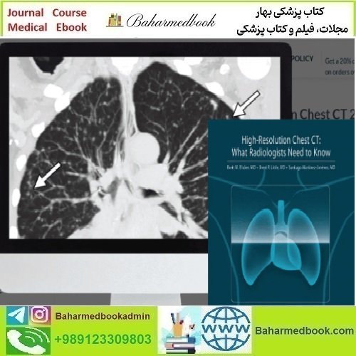 ARRS High Resolution Chest CT 2024 video course price 55€ - کتاب پزشکی بهار