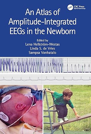 خرید و دانلود An Atlas of Amplitude-Integrated EEGs in the Newborn (3rd Edition)