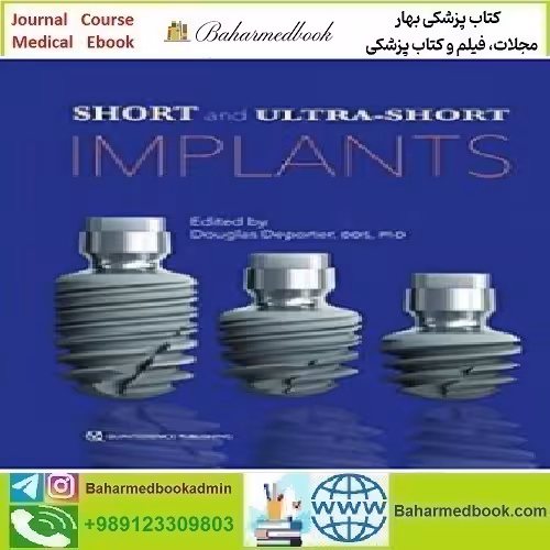 Short and Ultra Short Implants 2018 TRUE PDF price 1€ - کتاب پزشکی بهار