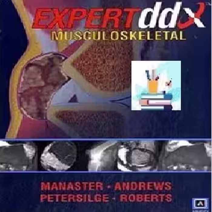 EXPERTddx Musculoskeletal TRUE PDF price 1€