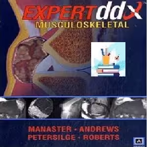 EXPERTddx Musculoskeletal TRUE PDF price 1€