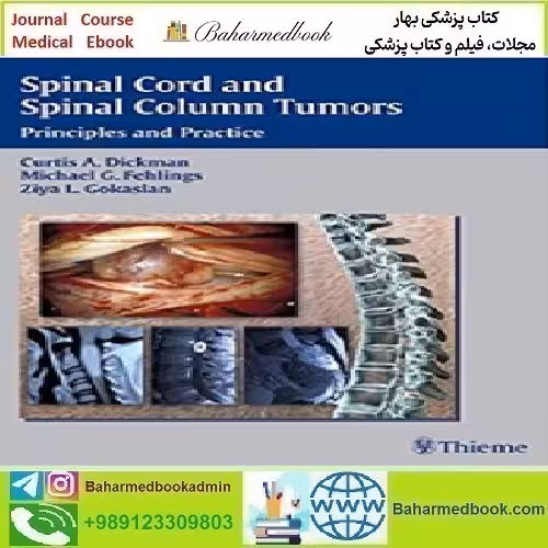Spinal Cord and Spinal Column Tumors Principles and Practice 2