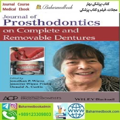 Journal of Prosthodontics on Complete and Removable Dentures