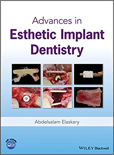  دانلود کتاب Advances In Esthetic Implant Dentistry, 2019 - دانلود کتاب های دانشگاهی