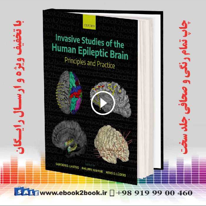 Invasive Studies of the Human Epileptic Brain