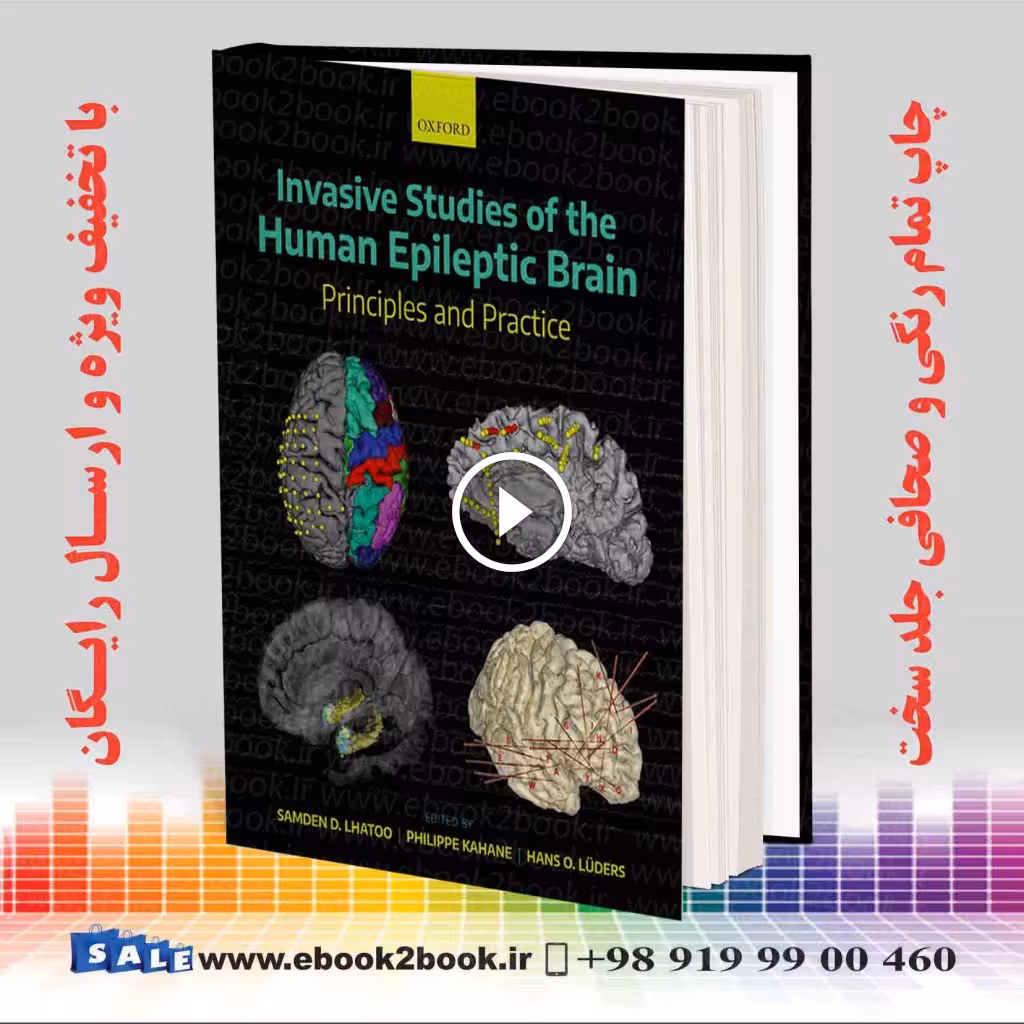 Invasive Studies of the Human Epileptic Brain