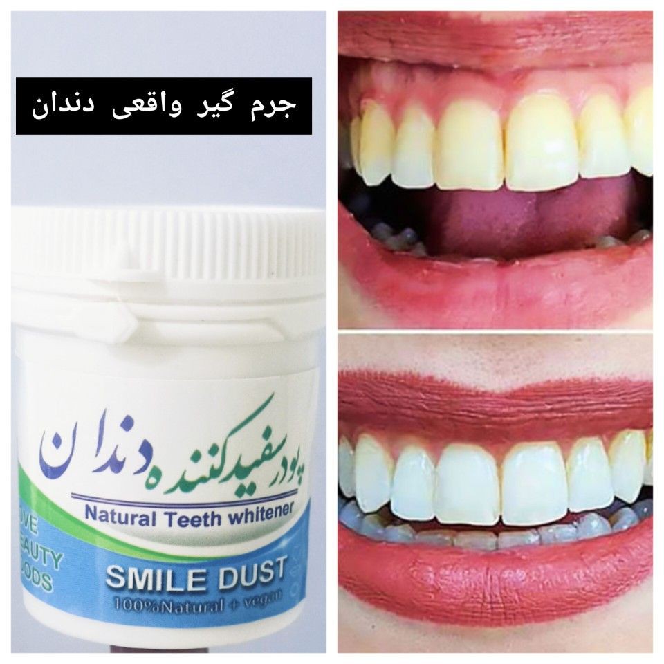 پودر دندان