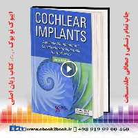 Cochlear Implants
