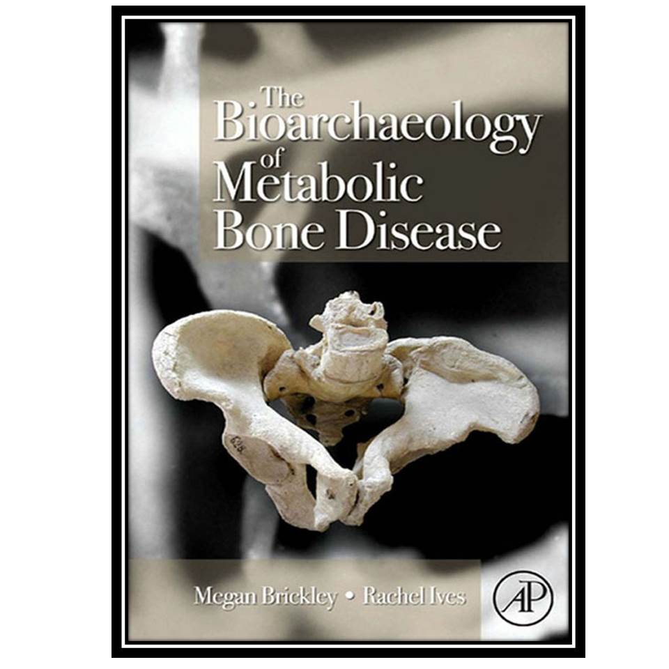 کتاب The Bioarchaeology of Metabolic Bone Disease اثر Megan Brickley and Rachel Ives انتشارات مؤلفین طلایی