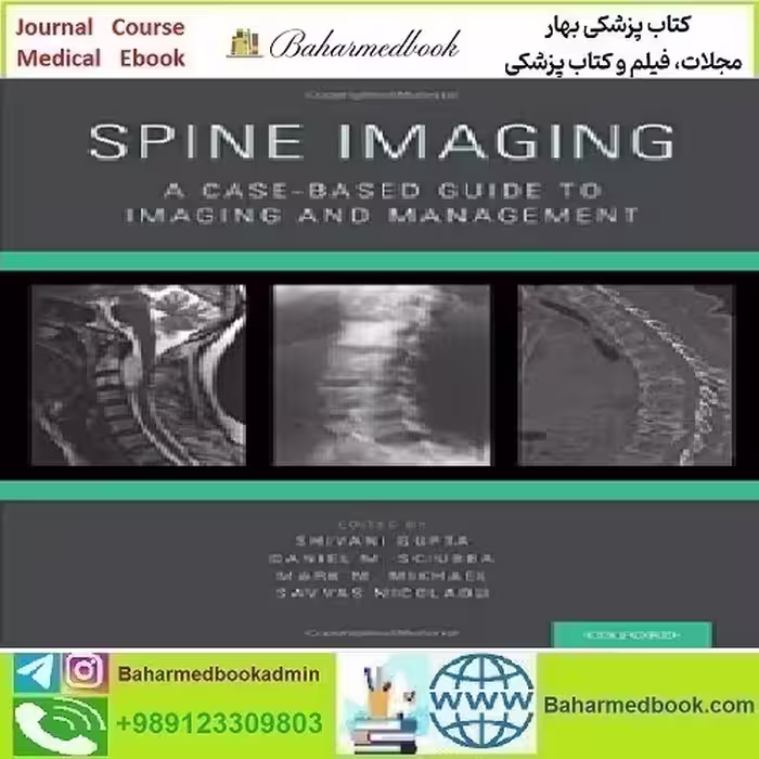 Spine Imaging A Case Based Guide to Imaging and Manag
