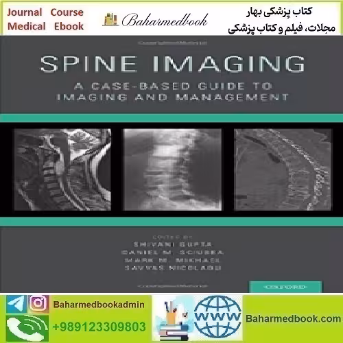 Spine Imaging A Case Based Guide to Imaging and Manag