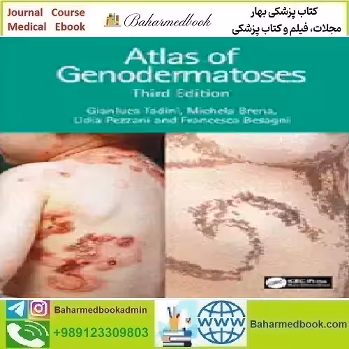 Atlas Of Genodermatoses 2024 TRUE PDF price 6€ - کتاب پزشکی بهار
