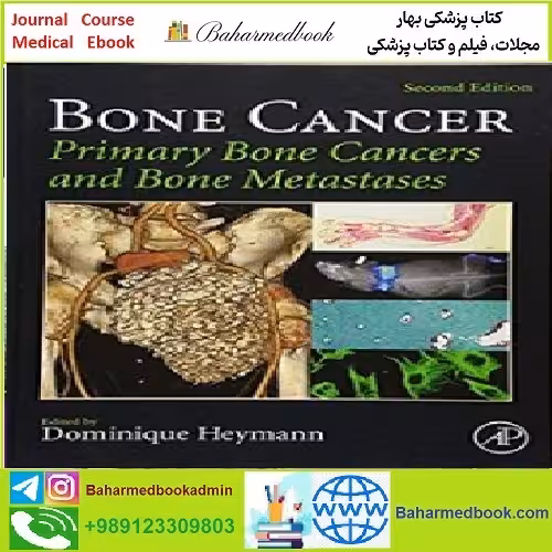 Bone Cancer Primary Bone Cancers and Bone Metastases TRUE
