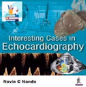 Interesting Cases in Echocardiography TRUE PDF price 1€