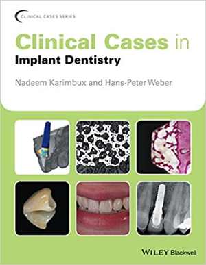 [PDF] دانلود کتاب Clinical Cases In Implant Dentistry, 2017