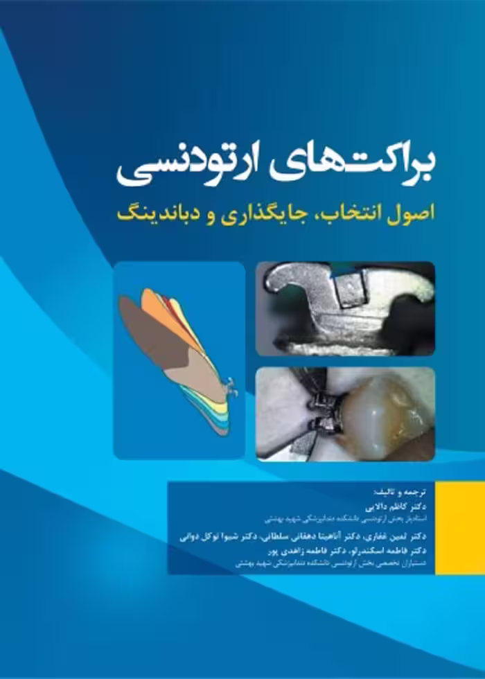 براکت های اورتودنسی اصول انتخاب، جایگذاری و دباندینگ