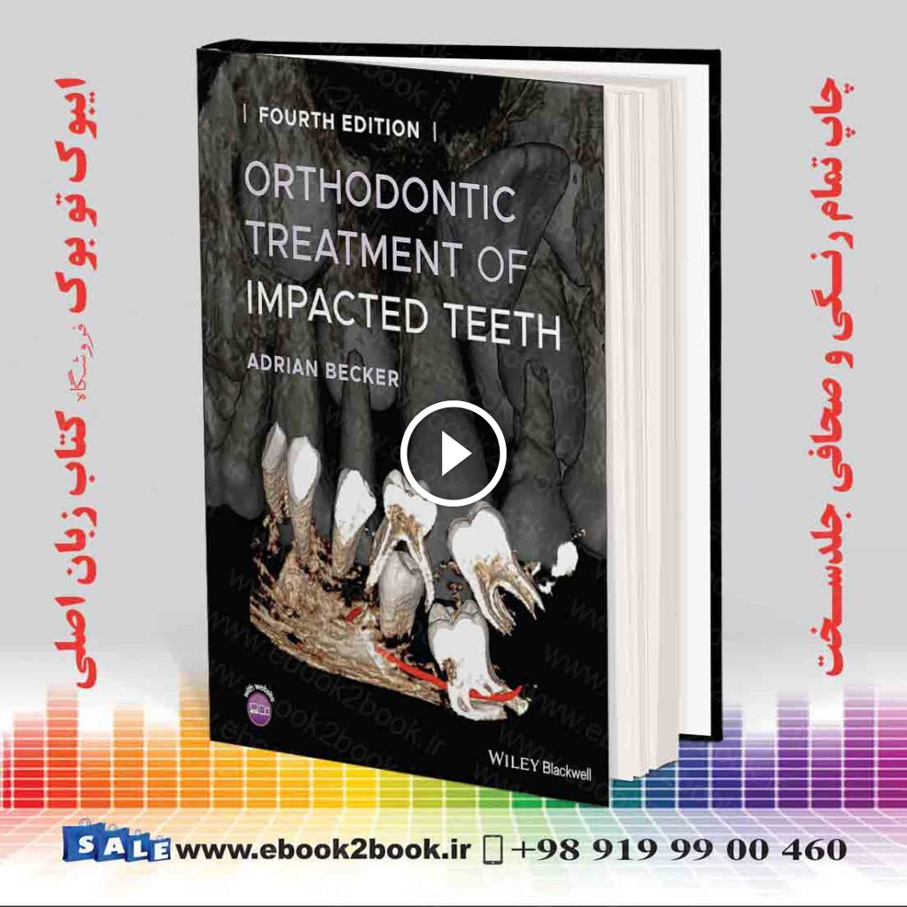 Orthodontic Treatment of Impacted Teeth 4th Edition