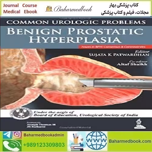 Common Urologic Problems Benign Prostatic Hyperplasia TRUE