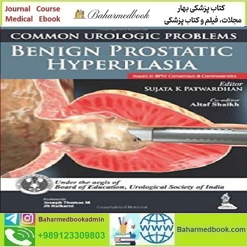 Common Urologic Problems Benign Prostatic Hyperplasia TRUE