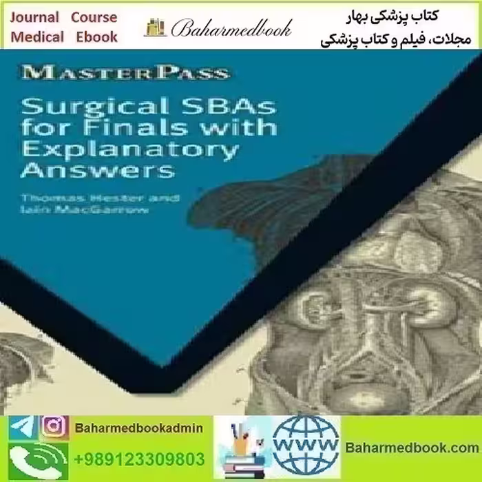 Surgical SBAs for Finals with Explanatory Answers 200
