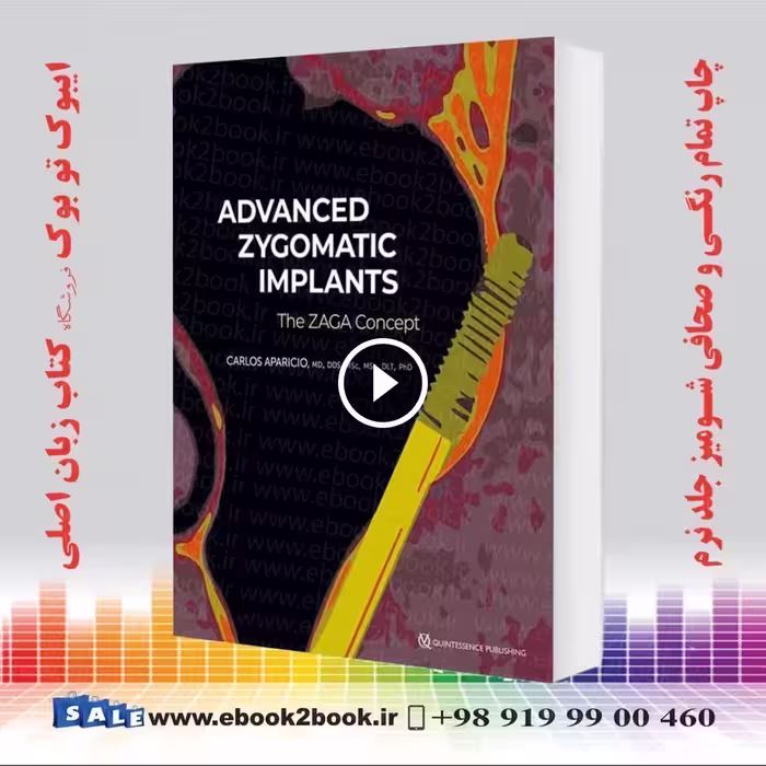 Advanced Zygomatic Implants: The Zaga Concept