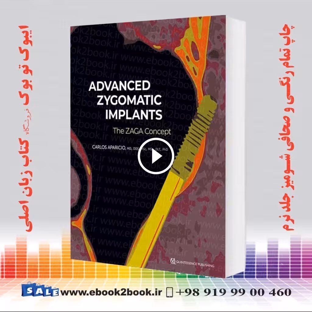 Advanced Zygomatic Implants: The Zaga Concept